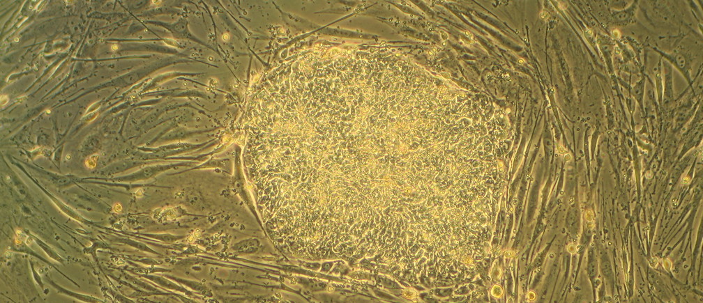Close up shot of a cell in yellow color